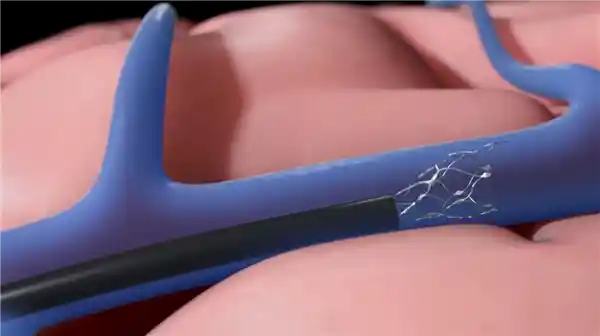 意念操控iPad!渐冻症患者首曝‘苹果脑控’实机视频